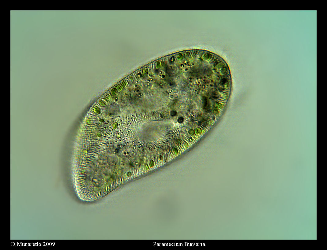 Paramecium Bursaria...400x